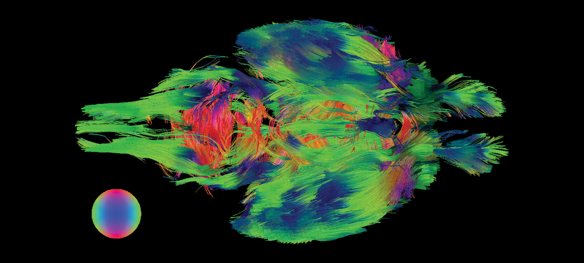 MRI of a mouse brain