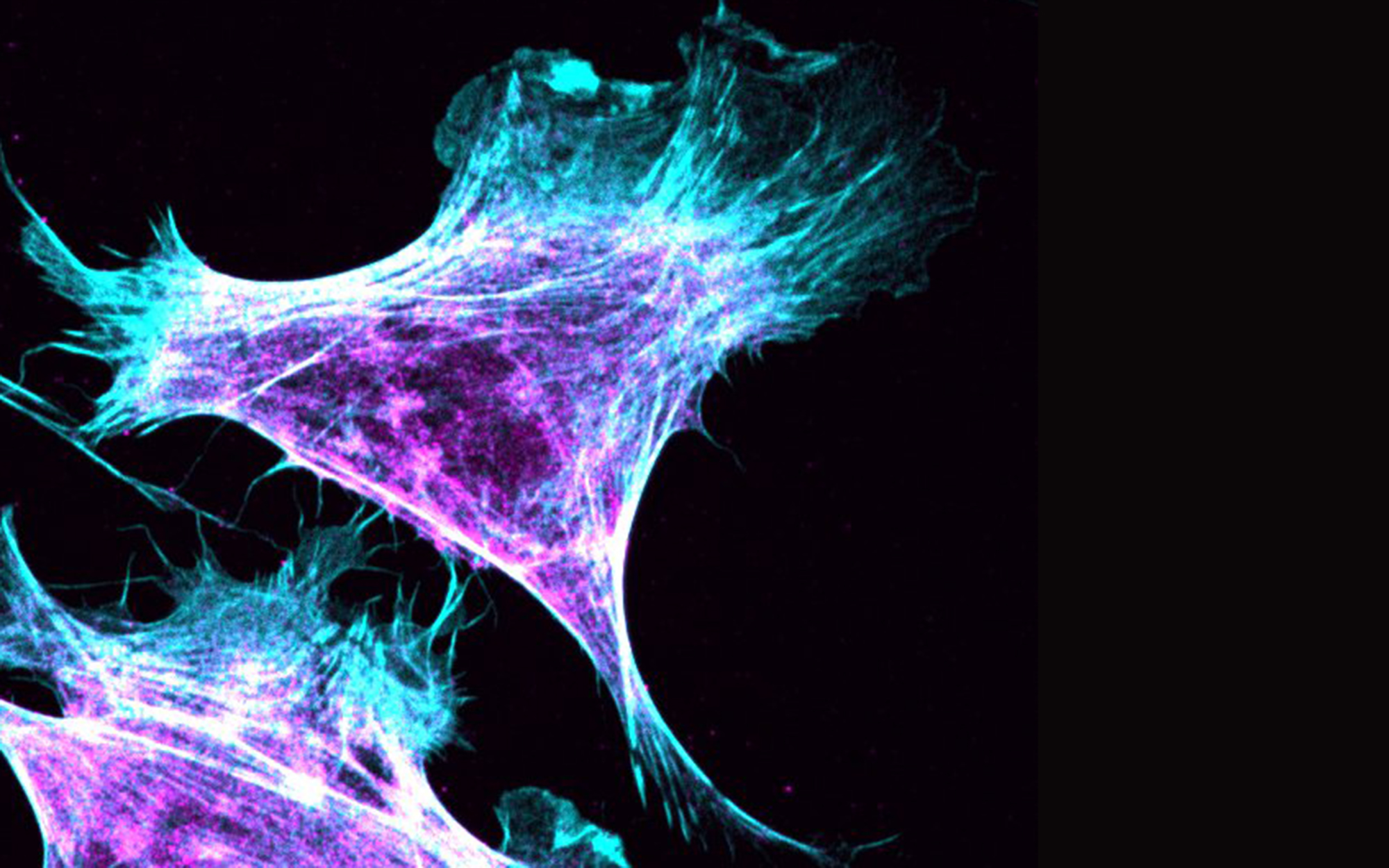 migrating fibroblast Migrating fibroblast.