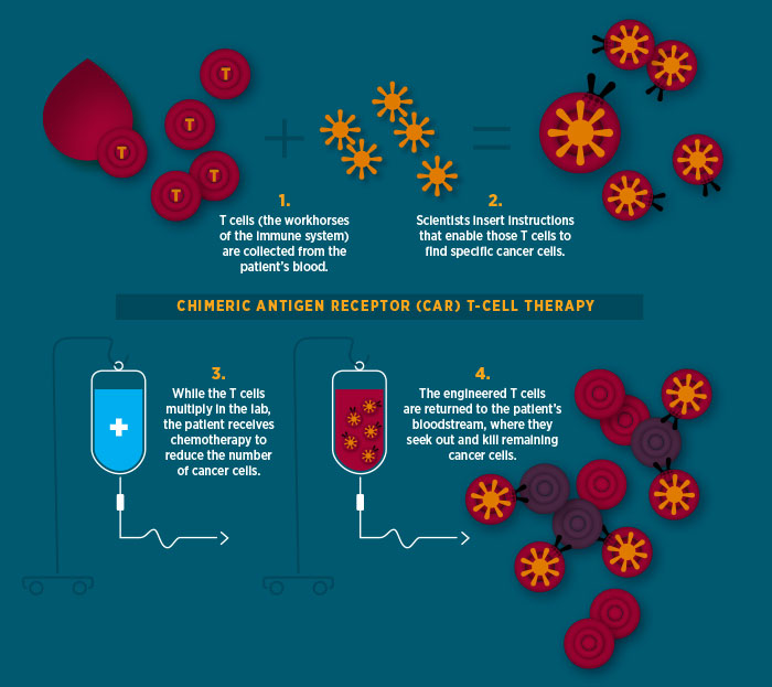 Diagraph of CAR T-cell therapy