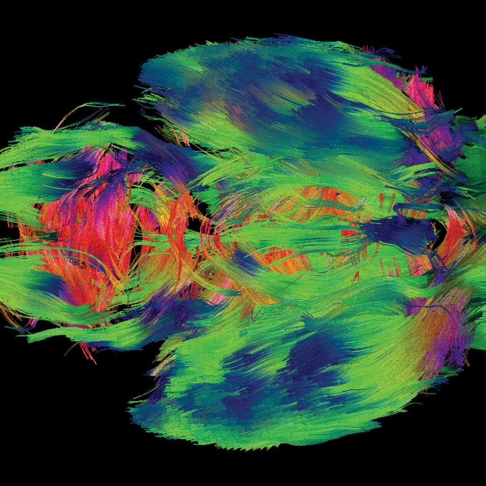 MRI of a mouse brain